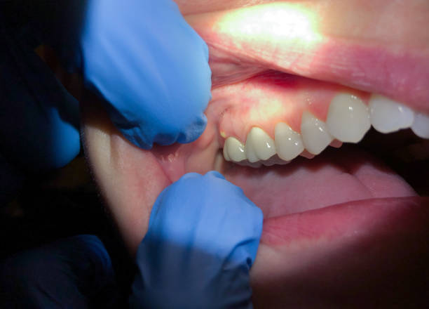 Best Dentist Open Late Near Me  in South Henderson, NC